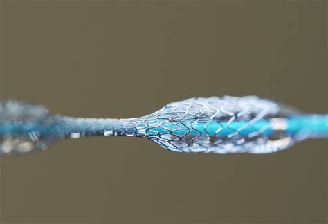 Nitinol: Biocompatibilidad e Implantación Médica para el Futuro!